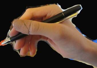 handwriting with thumb hypermobility