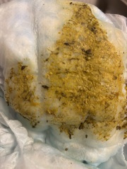 Black bits in baby poo [MNHQ content warning: Contains graphic photos]