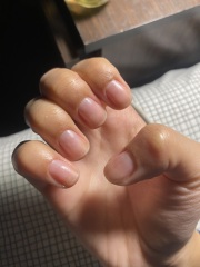 Nail lifting from bed after mani!!
