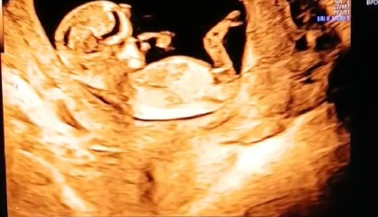 12+3, any gender guesses?🩷💙