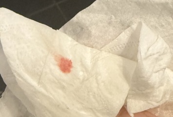 Is this implantation bleeding?