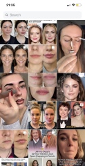 Why do people get massive amounts of lip filler?