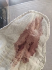Implantation bleeding or early light period?!