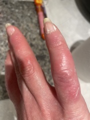 My sausage fingers need help!