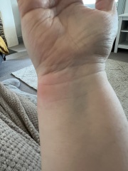 Identify my bites!