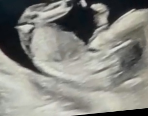 Nub theory - gender guesses? :)