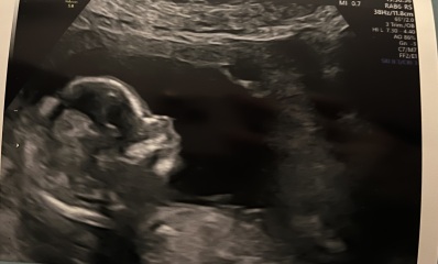 Due June 2025 pt2!