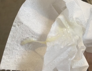 Is this mucus plug? TMI PIC WARNING