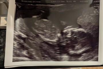 14 weeks, any nub?
