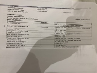 Trying to find an answer to daughters fatigue