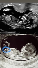 Nub and skull theory guesses 12+5
