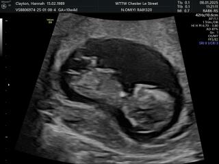 Anyone doing FET/IVF in November 2024?✨