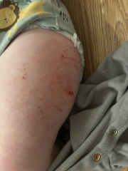 The November 2023-ish babies - the further adventures of…