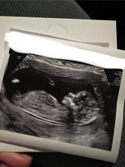 Gender Idea? Nub theory