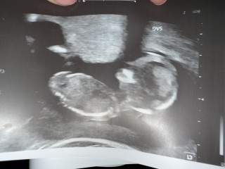 Boy or girl