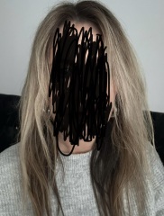 Have I ruined my hair ? Pics included -please help