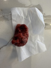 TW* gross picture. Period Help worried