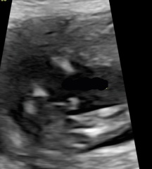 Definitely a boy?