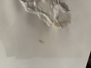 What is this discharge? *Pic*