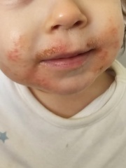 Has anyone had or seen anything like this?