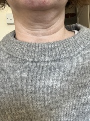 Help! My neck looks terrible! (Pics)