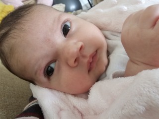 Worried for chromosome syndromes