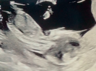 Nub theory - gender guesses? :)