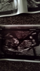 Guess the gender