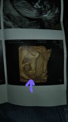 Can u guess the gender? Do they look the same at this time? 😄