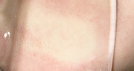 Eight year old temp staying around 40 despite Calpol