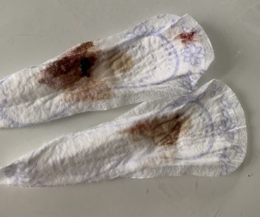 TW BLOOD/ is this bloody show?