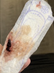 TW BLOOD/ is this bloody show?