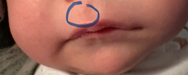 MIL kissed baby on the head with a coldsore