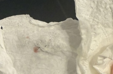 Is this implantation bleeding?