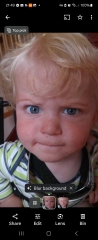 Toddler - one pupil noticeably bigger than the other