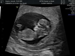 Anyone doing FET/IVF in November 2024?✨