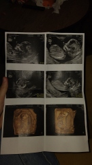 Can u guess the gender? Do they look the same at this time? 😄