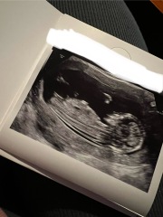 Gender Idea? Nub theory