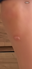 Could this be skin cancer?