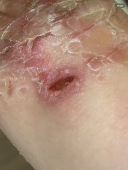Does this look like it’s healing okay?