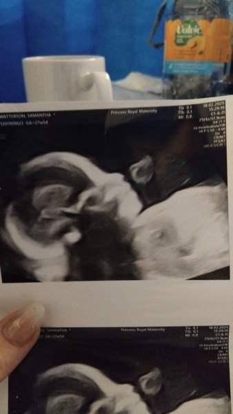 Boy or girl :)