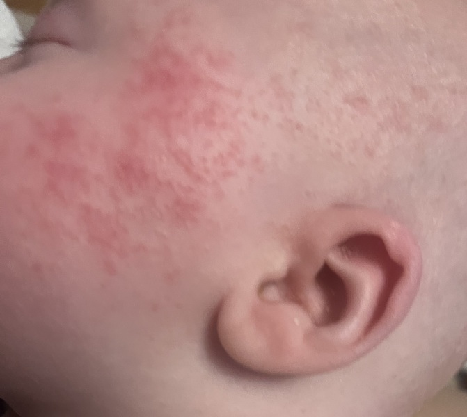 Is this normal?