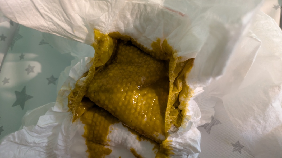 Shiga Toxins - advice/explanation please