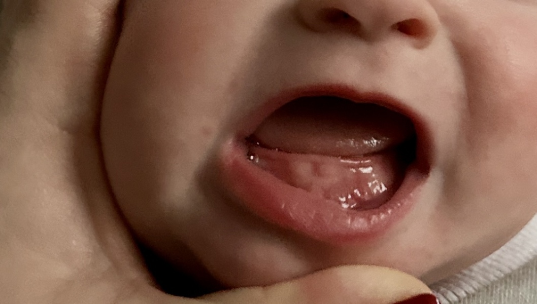 Are these teeth looking like they’re going to cut through?