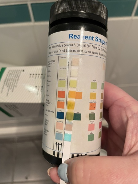 Urine dip sticks *pics included*
