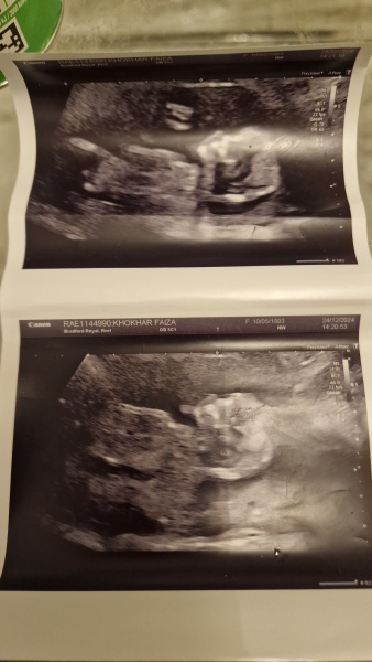 Re scan done - want opinions :)