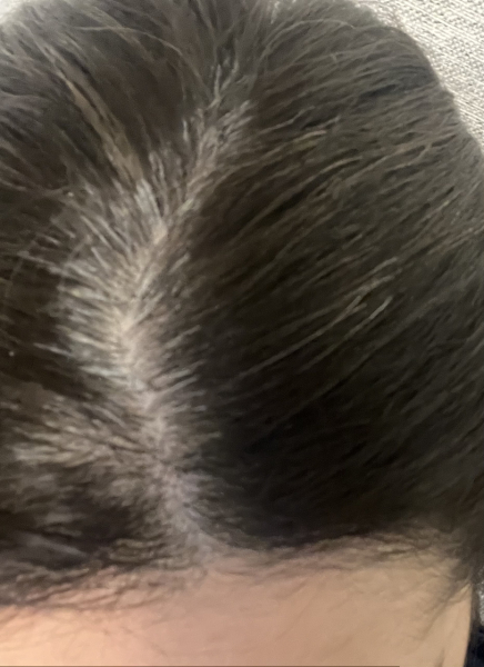 Hair roots
