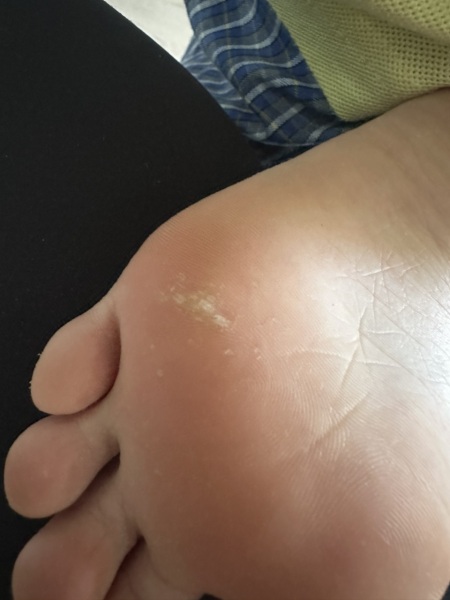 What could this be? Foot pic
