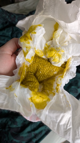 Allergy? Sudden change in poop