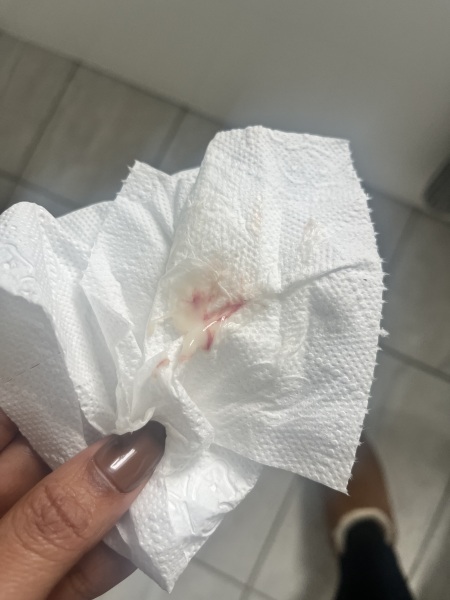 Clear discharge with red streaks